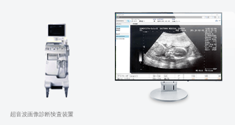 超音波画像診断検査装置 
